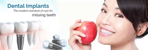 Dental Implant services in Gomti Nagar Lucknow | Dental Implant ...