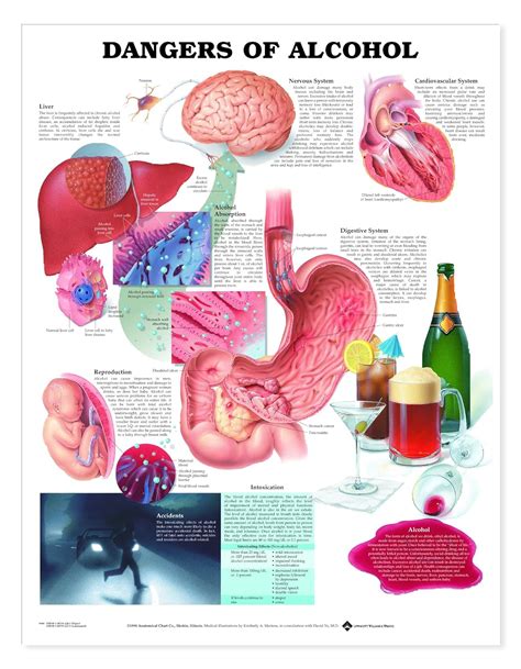 Buy Dangers of Alcohol Anatomical Chart Book Online at Low Prices in ...