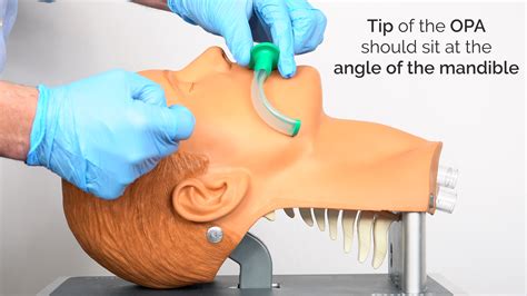 Oropharyngeal Airway (Guedel Airway) Insertion - OSCE Guide | Geeky Medics