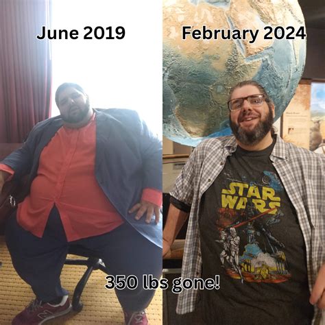 350 lbs (158 kg) lost! : r/BariatricSurgery