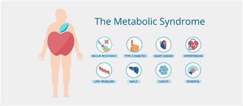 Metabolic syndrome - The dangerous cluster of risk factors