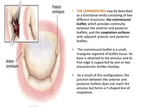 Mitral valve anatomy | PPTX - structure of leaflet