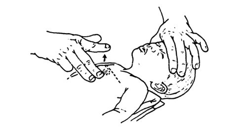 Lesson 6. Perform Cardiopulmonary Resuscitation on a Child or Infant ...