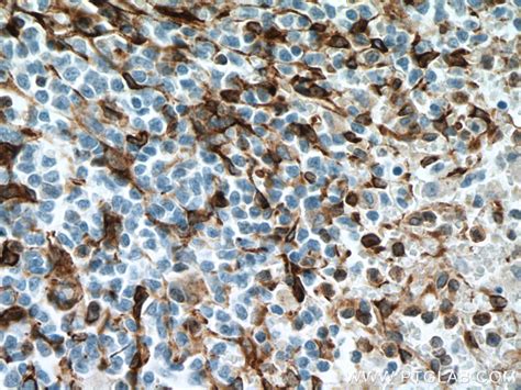 TMEM173/STING antibody (66680-1-Ig) | Proteintech