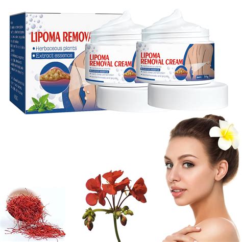 Buy 1/2/4Pcs LipoPRO Instant Lipoma Removal Cream, LumpFree Lipoma Removal Cream, Skin Anti ...