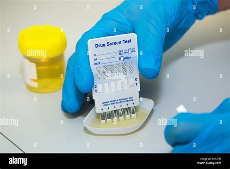 Drug Lab Multi-Drug Screen Test at Kenneth Jankowski blog