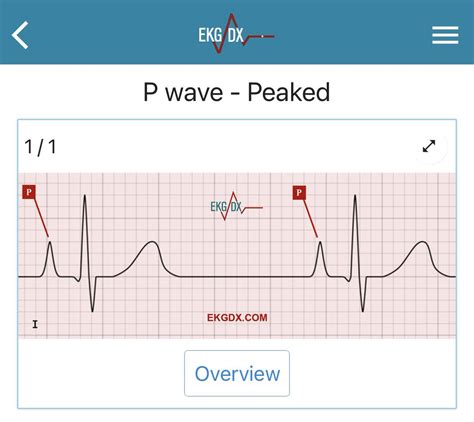 Thread by @ekgdx on Thread Reader App – Thread Reader App