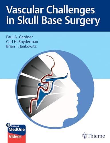 Buy Vascular Challenges in Skull Base Surgery Book Online at Low Prices ...