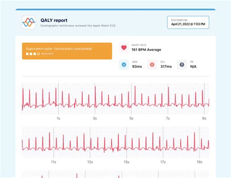 QTc Interval on Your Watch ECG - Short, Normal, and Prolonged | Qaly