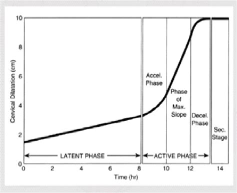 Image result for Partogram Examples