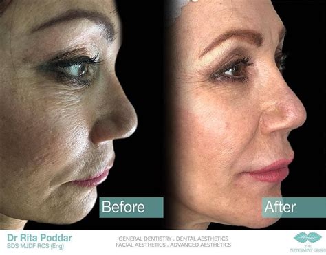 zo skincare regime