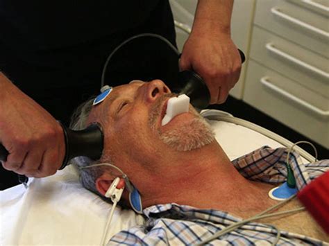 Electroconvulsive Shock Therapy