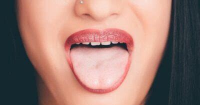 நாக்கு புண்களுக்கான காரணம் | Causes of tongue ulcer in Tamil