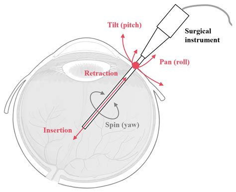 Research and Realization of an OCT-Guided Robotic System for Subretinal ...