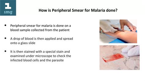 Peripheral smear for malaria | ODP