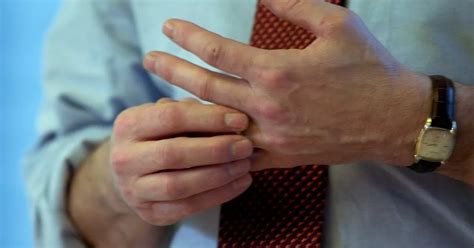 Cracking your knuckles can actually be GOOD for your hands - according ...