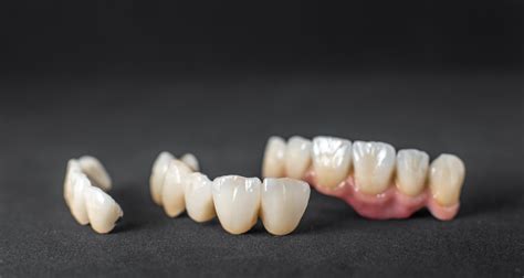 Dental Crown Material Zirconia at Martha Berman blog
