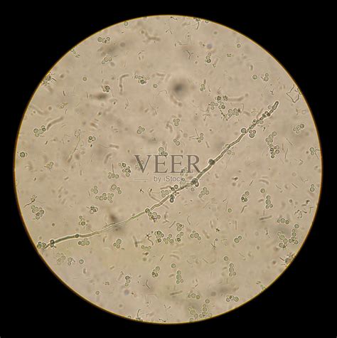 显微镜下观察白色念珠菌照片摄影图片_ID:332234908-Veer图库