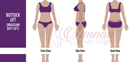 Brazilian butt lift workout time - volsurvey