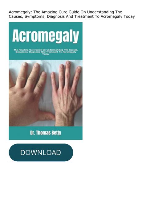 Ebook ️(D!ownload )⚡️ Acromegaly: The Amazing Cure Guide On Understanding The Ca
