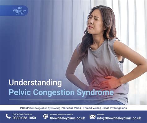 Understanding Pelvic Congestion Syndrome