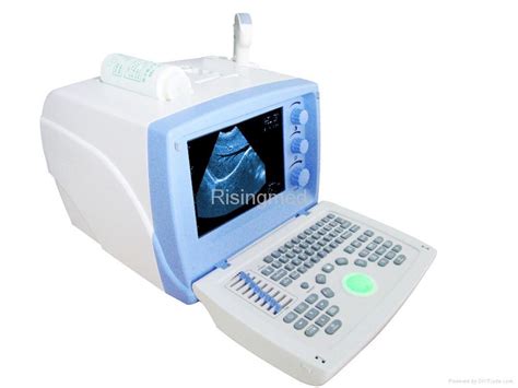 Ultrasound Scanner Machine 的图像结果