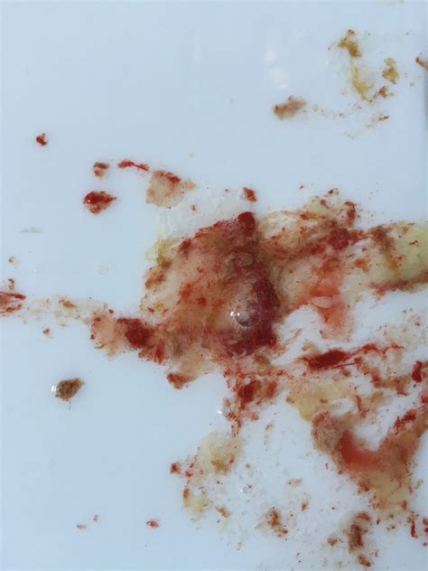 Coughing Up Mucus With Blood Coughing Up Blood: Causes And Signs Of An