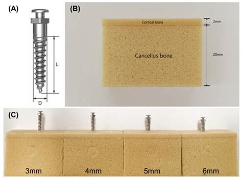 Effects of Intrabony Length and Cortical Bone Density on the Primary ...