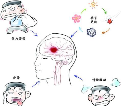 一分钟读懂高血压脑出血，出现这些症状时，一定要警惕！_中国
