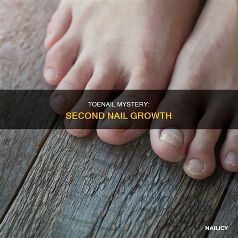 Toenail Mystery: Second Nail Growth | Nailicy
