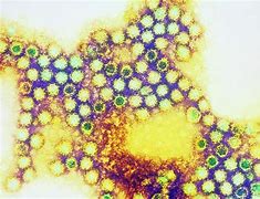 calicivirus 的图像结果