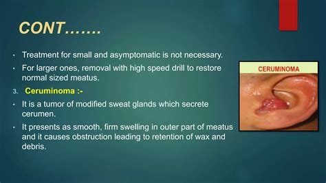 TUMORS OF EAR | PPTX
