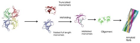 Ocular Involvement in Hereditary Amyloidosis