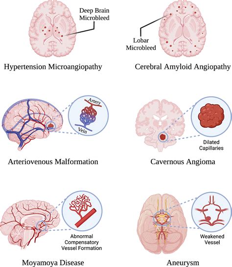 Caa Medical Conditions