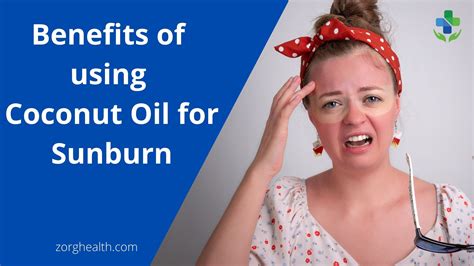 Benefits of using Coconut Oil for Sunburn - Zorg Health