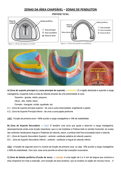 Zonas DA AREA Chapeavel - ZONAS DA ÁREA CHAPEÁVEL – ZONAS DE PENDLETON ...