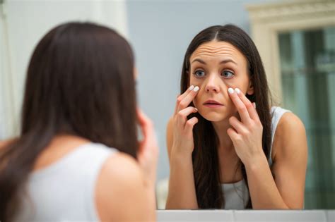 Hinchazón de los pómulos, ¿requiere cirugía estética? | El Especialista ...