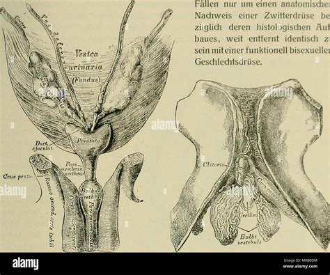 Hermaphroditismus beim menschen 1908 hi-res stock photography and ...