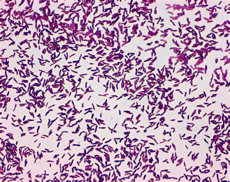 Corynebacterium Diphtheriae Albert Stain