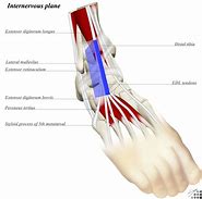Image result for anterolateral