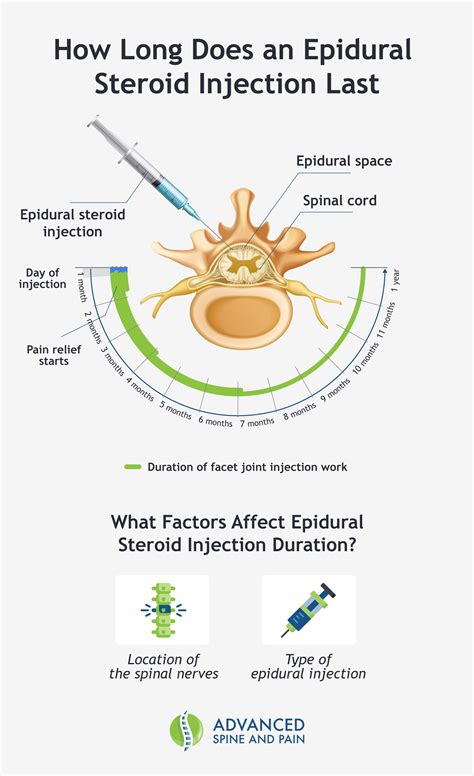 How Long Does Epidural Last