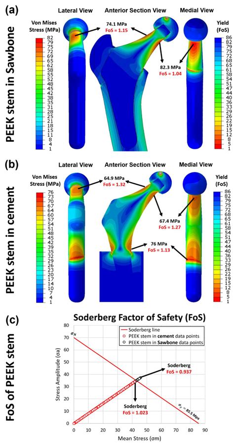 Stress Shielding and Bone Resorption of Press-Fit Polyether–Ether ...