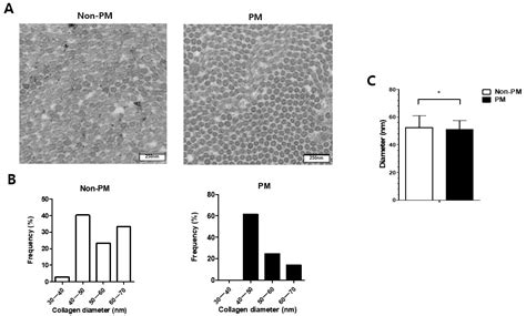 Effects and Mechanism of Particulate Matter on Tendon Healing Based on ...