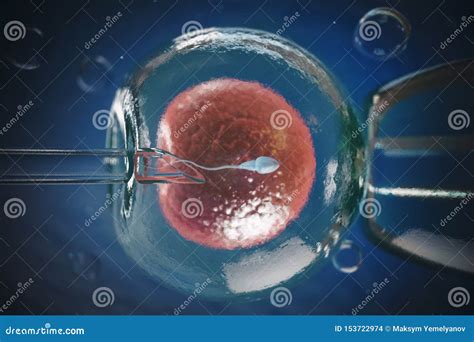 Artificial Insemination, In Vitro Fertilization IVF Of Human Egg Cell Or Fertility Treatment ...