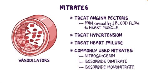 What Are Nitrate Drugs and Their Uses