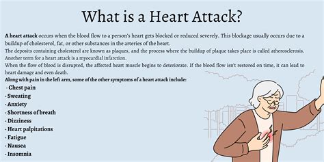 Is Underarm Pain A Sign Of Heart Attack at Alica Martel blog