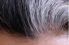 Hair Turning With Age by Can Fright Really Turn Your Hair White Times Knowledge Hair Turning With Age