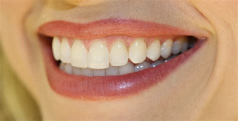 Ace Group Dentist, Dentist India, Delhi Dentist, Mumbai Dentist, Jaipur ...