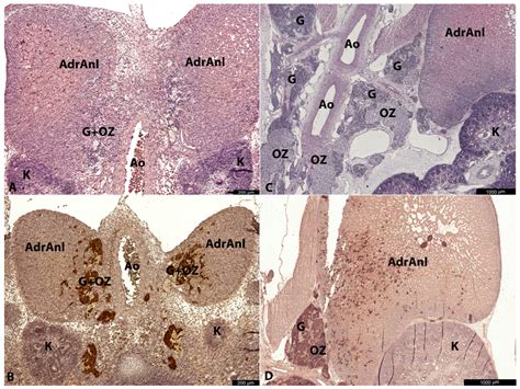 Developmental Parallels Between the Human Organs of Zuckerkandl and ...