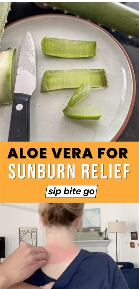 Tips for using aloe vera for sunburns – Artofit